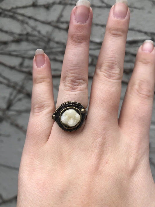 Bronze Denture Tooth Ring