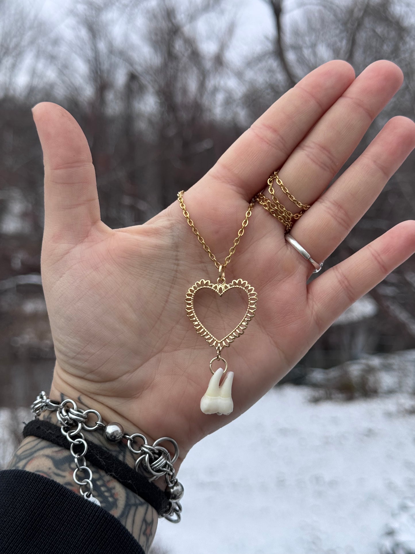 Gold Lace Heart Human Tooth Necklace